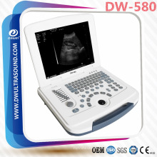 DW-580 ecografo veterinario, dispositivo portátil de ultrasonido